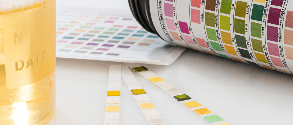 Image of reagent strips and urine cup for urinalysis for 5-panel drug tests.